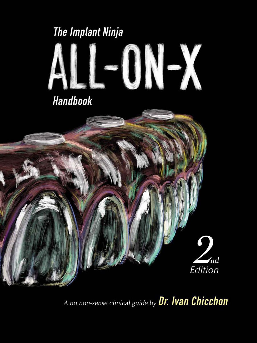 ALL-ON-X Handbook